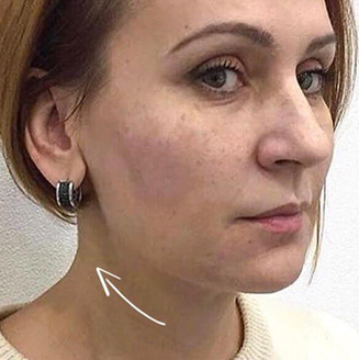 фото жінки зі стрілочкою на шиї